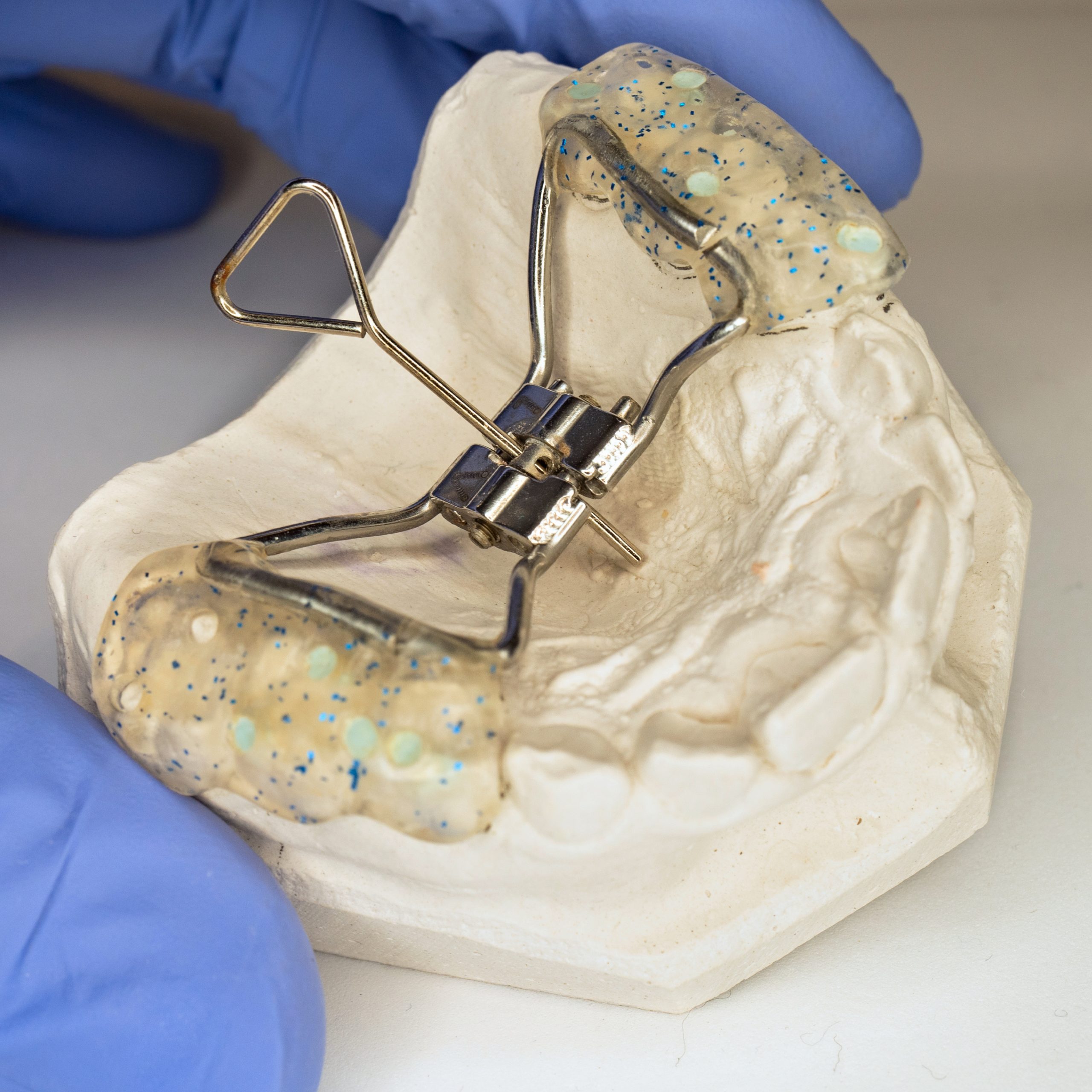 allineatori trasparenti